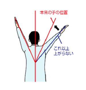手の位置