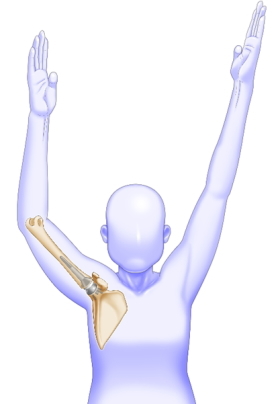 リハビリ後の肩の挙がり方