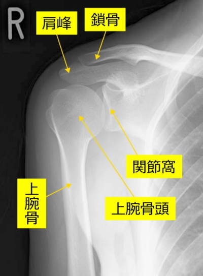 正常なレントゲン
