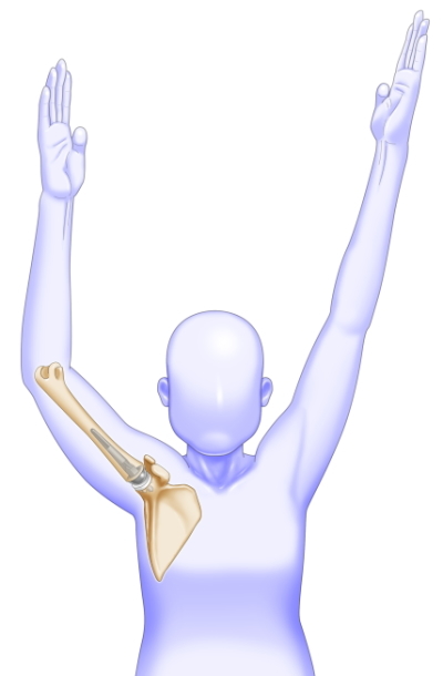 リハビリ後の肩の挙がり方