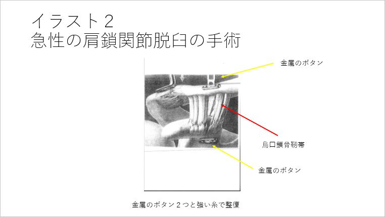イラスト2
