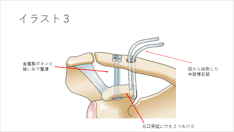 イラスト3
