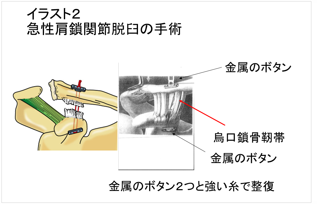 イラスト2