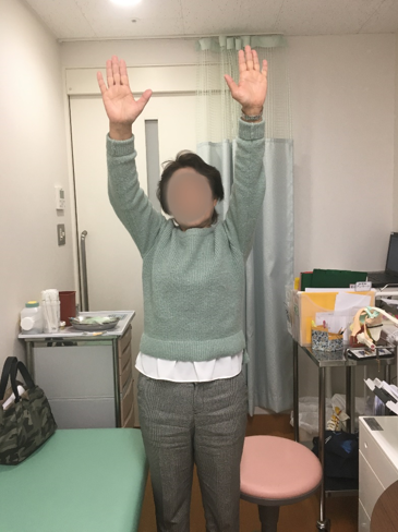 術後2年での肩の動き