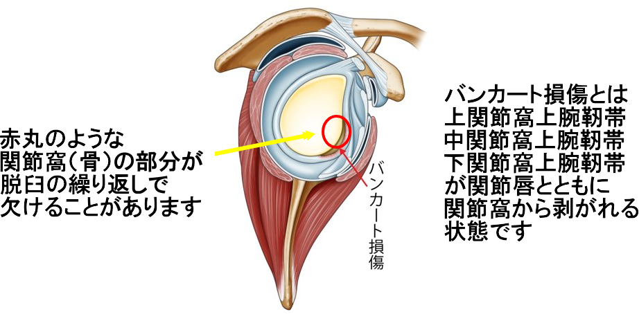 右肩のイラスト​