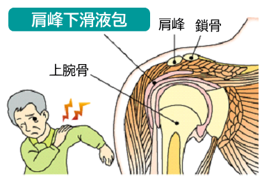 肩峰下滑液包