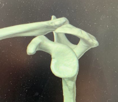 CT images 1